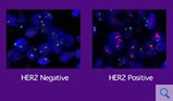 med-her2-200px[1].jpg